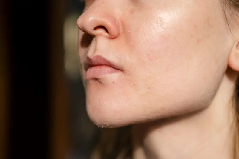 apa itu moisturizer