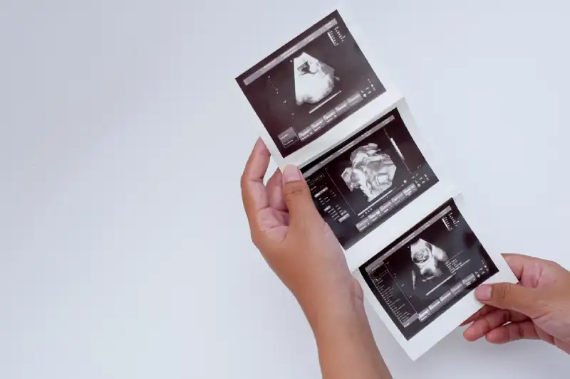 Perbedaan Hasil USG Bayi Laki-Laki dan Perempuan yang Perlu Calon Mama